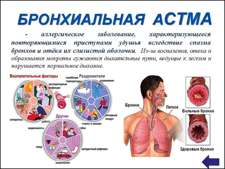 Табиблар бронхиаль астманың килеп чыгу, дәвалау ысулларын аңлата